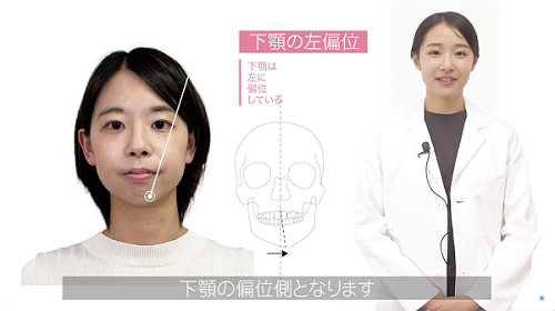 20240611_facial-1
